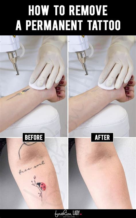 We did not find results for: How To Remove A Permanent Tattoo (With images) | Permanent tattoo, Tattoos, Bad tattoos