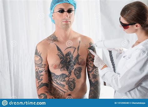 Manly removals is headquartered in north manly, new south wales. Man Undergoing Laser Tattoo Removal Procedur Stock Photo ...