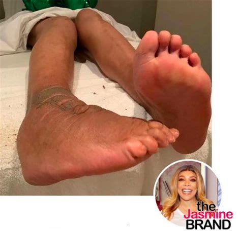 Wendy williams‏verified account @wendywilliams 22 oct 2018. Wendy Williams Shares Rare Photo Of Chronic Foot Condition ...