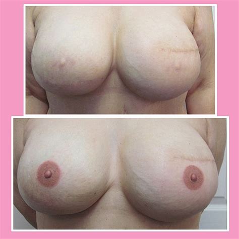 Studio meraki, portland's premier cosmetic tattoo studio offers areola restoration services. VINNIE MYERS