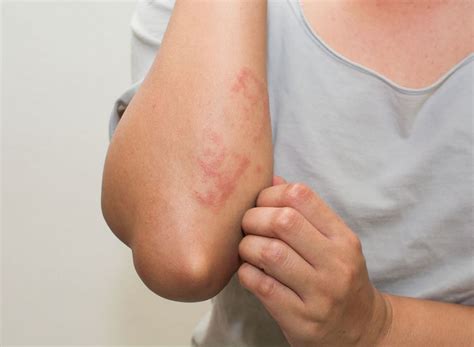 Covid toes, or unexpected skin rashes have been a covid symptom that could strike kids. 13 COVID Symptoms That Have Doctors Scared