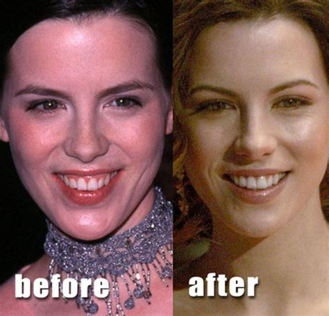 These Celebs are Examples of Good Plastic Surgery ...