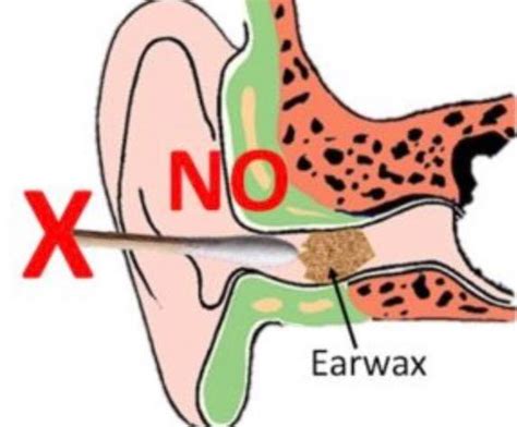 Struktur telinga manusia, mekanisme mendengar, kelainan dan cara menjaga kesehatan telinga. 3 Sebab Kenapa Korang Tak Perlu Korek, Doktor Ini Jelas ...