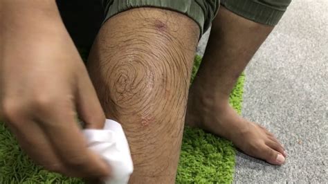 Their are many ways to remove hair from legs how ever some last a bit longer then others.but wax hair removal has proven to be the best it gives you a smooth long lasting result at a fraction of the cost. Leg - Hair Removal Cream - YouTube