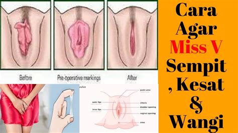 Pun demikian untuk membuat aroma vagina senantiasa wangi. Cara Agar Miss V Kesat Dan Rapat - YouTube