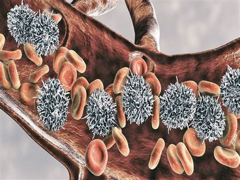 The survival rates vary depending on the exact type of bone cancer and the prognosis for the disease. Bone Marrow Cancer | What is bone marrow cancer? Types ...