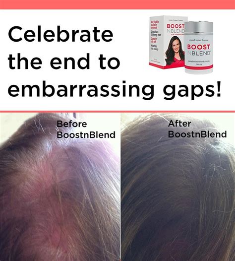 But, if you're looking for the gold standard, this is it. Hide embarrassing gaps and thin hair with BoostnBlend ...