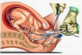 Después de un aborto espontáneo, el objetivo principal del tratamiento es la prevención de el legrado puede llevarse a cabo en una clínica o en un hospital, y la anestesia puede ser general o. EL ABORTO