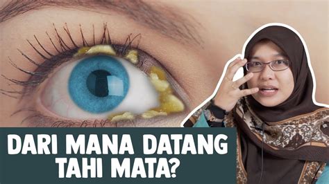 Antara langkah yang boleh dilakukan ialah: Dari Mana Datang Tahi Mata? - YouTube