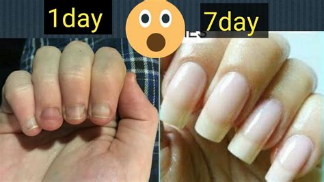 Hamal test karne ka tarika. How to get strong nails/nails ko bada karne ka tarika/nails grow faster/Arshiz channel - YouTube