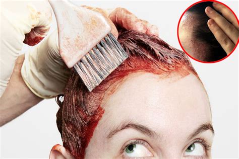 Hair dye allergies can cause severe distress for those with allergies or sensitive skin. Home remedies for skin allergy due to hair dye - India TV ...