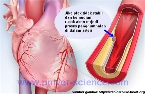 Jika fungsi jantung sebagai pompa darah terganggu, akan menyebabkan darah terakumulasi di berbagai organ tubuh karena tidak dipompa dengan baik. Tanda-Tanda Serangan Jantung Dan Gejalanya