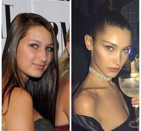 A blur slowly transforms itself into a view of sickbay on the uss voyager from a lying position. Bella Hadid before and after en 2019 | Operacion de nariz ...