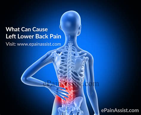 Poor body positioning creates tension in your back, shoulders, and neck. What Can Cause Left Lower Back Pain|Symptoms|Treatment