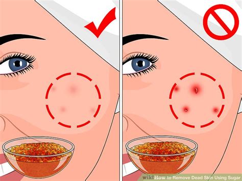 How can i get rid of dirt on my face? How to Remove Dead Skin Using Sugar (with Pictures) - wikiHow