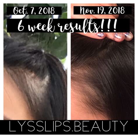 Hair serums are made up of silicon based silicon based content, amino acids and ceramides. Senegence HairCovery Hair Serum Results #personalresults # ...