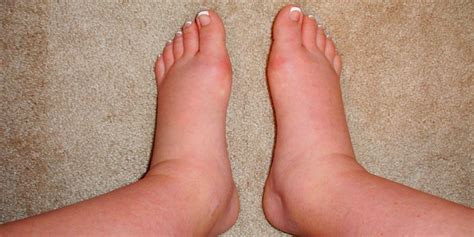 Mengecilkan perut hanya dalam seminggu? Obat Herbal Sembuhkan Perut Dan Kaki Bengkak | Cara ...