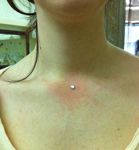 Chest piercings has gained immense popularity in the past decade. Chest Dermal : Body Piercing