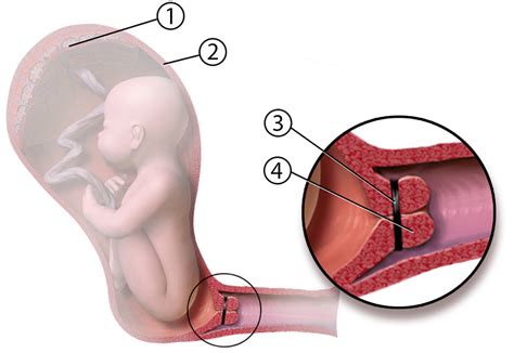 Fetal development occurs between the embryonic stage of development and birth in humans. El cerclaje con anillo de silicona - Canal Chupete