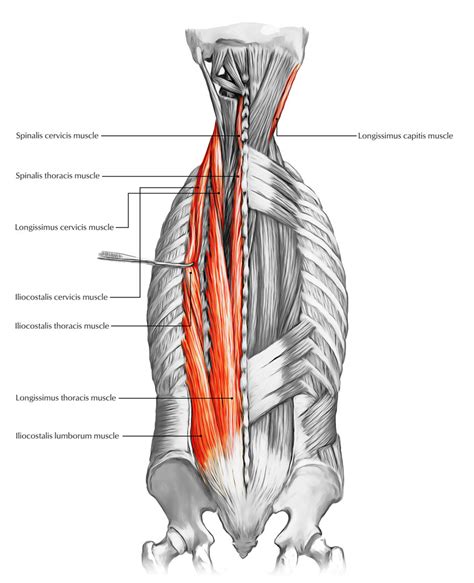 The origins and insertions are described as though the fibers run caudocranially. Erector Spinae Back Muscle Anatomy - Human Anatomy