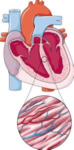 Algunos exámenes proponen que es una razón crítica para el pase súbito inexplicado (20%) en adultos menores de 40. ¿Qué es una miocarditis? ¿Puede tener complicaciones graves?