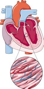 Esta enfermedad se llama miocarditis y, según los expertos, es poco frecuente. ¿Qué es una miocarditis? ¿Puede tener complicaciones graves?