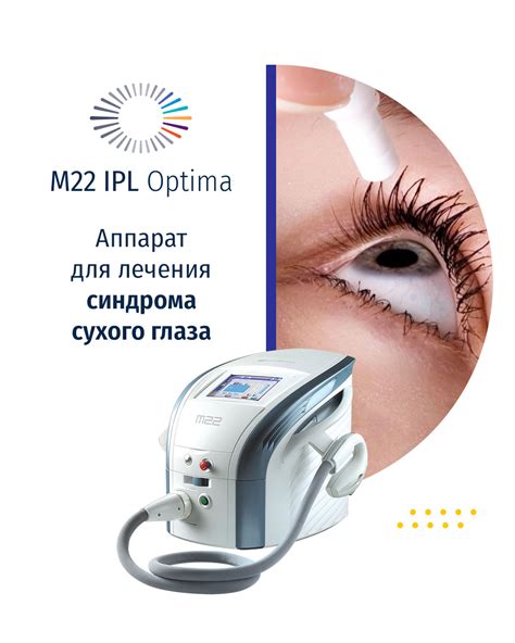 Лечение синдрома сухого глаза (ССГ) с помощью М22 IPL-терапии