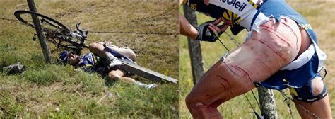 Hitting one of the riders. 名無しのVIP : ツールドフランスで事故った男 ユニフォームが破れ尻丸出しになるの巻