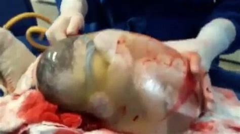 Thoracic cavity below the neck • primary hormones: Video: Rare moment of baby born inside fully intact ...