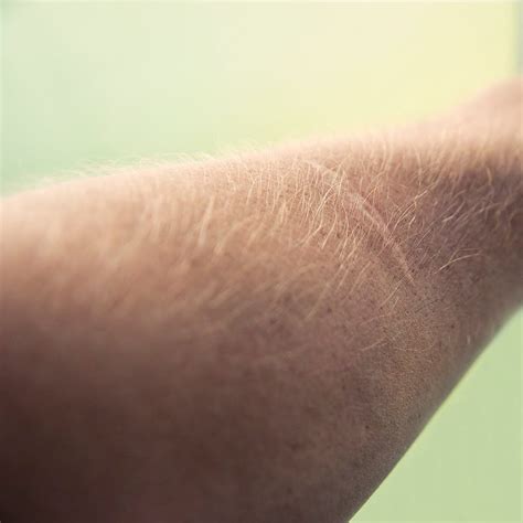 Discover the causes of this change in armpit skin color and five simple lifestyle remedies to lighten it. - (guy, arm hair, dude, forearm) - | Arm hair, Teacher ...