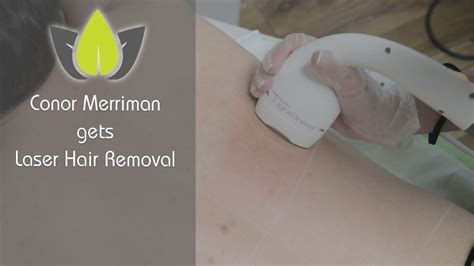 The bakblade 2.0 offers the best hair removal option for men's backs and enables you to rid yourself of unsightly hair that you couldn't reach previously. Laser Hair Removal | Back & shoulder hair - YouTube