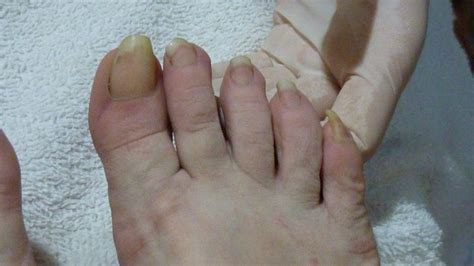 En esta ocasión, el último grito es dejarse largas las uñas de los pies, y el hashtag #longtoenails ( o lo que es lo mismo, uñas de los pies largas) ya es tendencia en instagram y son muchas las. Los pies son feos, pero {...} | @matituteee en Taringa!