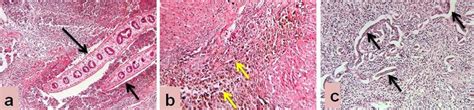 Label claim for rumen fluke. Sections of liver stained with H & E. Sections of liver ...