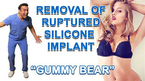 Browse the activebeat health content network. Removal of Ruptured "Gummy-Bear" Silicone Implant - YouTube