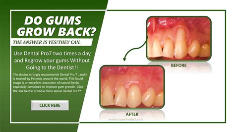 When should you cut back mums? Grow Gums Back Naturally by MarjorieBowlin - Issuu