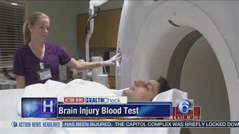 Blood test for head injuries? Researchers report some ...