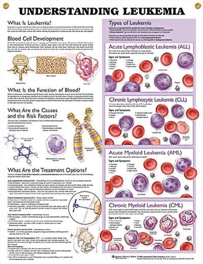 Leukemia is defined as the classification of cancer in which the bone marrow or blood contains an irregular increase of mature white blood cells, which are also known as blasts. it serves as part of the broader group of diseases that affect the lymphoid system, blood, and bone marrow. Understanding Leukemia Chart 20x26 | Oncology nursing ...