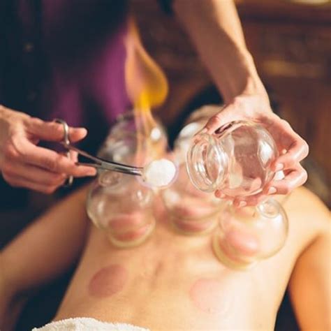 About hot cup therapy what's the verdict on hot cupping? Olympians are 'cupping' to speed up muscle recovery. Does ...