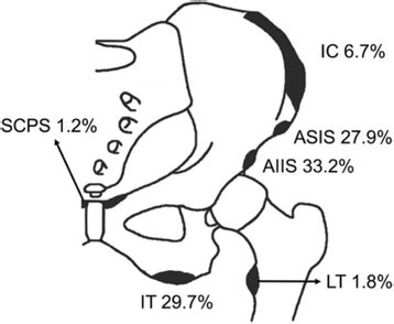 Operative versus conservative treatment of apophyseal ...