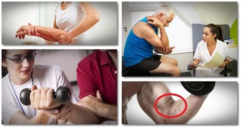 How to get rid of tennis elbow fast. How To Get Rid Of Tennis Elbow | "Tennis Elbow Secrets ...