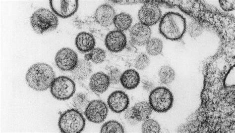 Deer mice carry the sin nombre strain of hantavirus. Alerta por virus mortal en EE.UU. | VOCES | PERU21