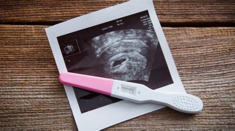 Auf dieser website finden eltern und werdende eltern wichtige informationen rund um das thema baby! Wo kauft man schwangerschaftstest - Kundenbefragung ...