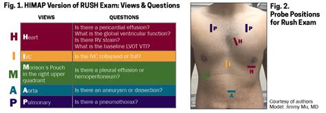 This is rapid ultrasound in shock (rush) exam by em ultrasound education on vimeo, the home for high quality videos and the people who love them. Stroke Volume Equation Vti - The Letter Of Recomendation