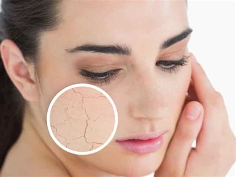 Maschere viso fai da te con ingredienti naturali: Maschere viso fatte in casa per pelle secca e grassa