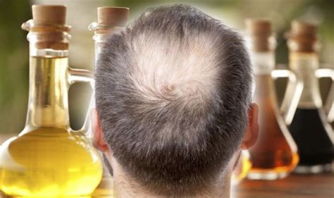 Science supports the use of apple cider vinegar as a hair rinse. Hair loss treatment: Apple cider vinegar could help with ...