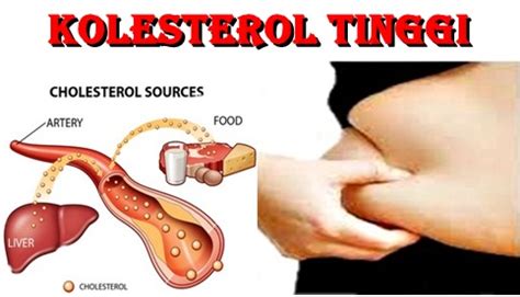 Serangan jantung adalah sebuah kondisi yang menyebabkan jantung sama sekali tidak bisa berfungsi. SIHAT CANTIK BERTENAGA: PUNCA KOLESTEROL TINGGI