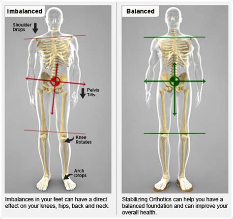 However, the spinal erectors travel the length of the entire spine. Posture Can Effect Your Health Both In A Positive And Negative Manner.