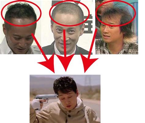 SMAP中居くんの薄毛、ハゲ疑惑の真相 | プロペシア効果・体験 ...