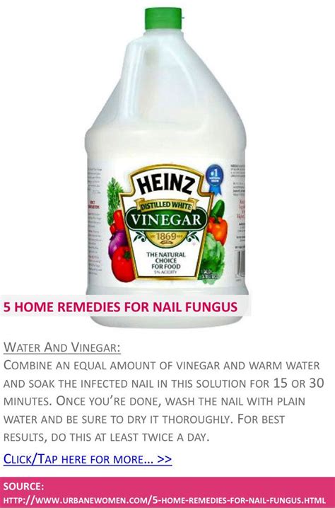 When done, dry your toenail add onehalf cup of baking soda, one4th cup of threepercent hydrogen peroxide and onehalf cup of epsom salt to four glasses of warm water. 5 Home Remedies For Nail Fungus | Warm, Home and Apple ...