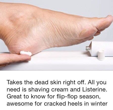 Get some duct tape and an onion and duct tape the onion to where ever the needles are and have it on for 12 hours. how to get dead skin off your feet | Dry skin body, Dry ...